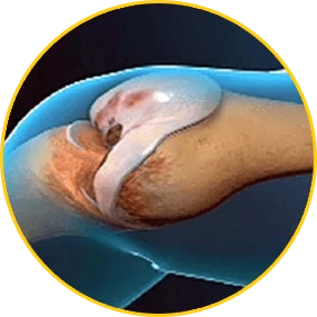 Immagine rappresentativa del processo di rigenerazione della cartilagine