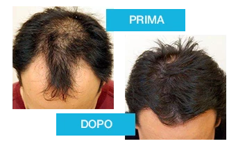 Trasformazione dei capelli con Profolan