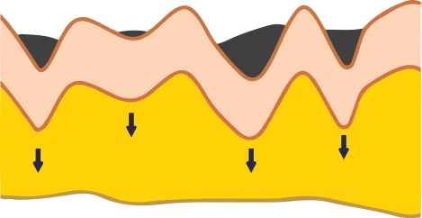 Grafico degli effetti dei cosmetici topici